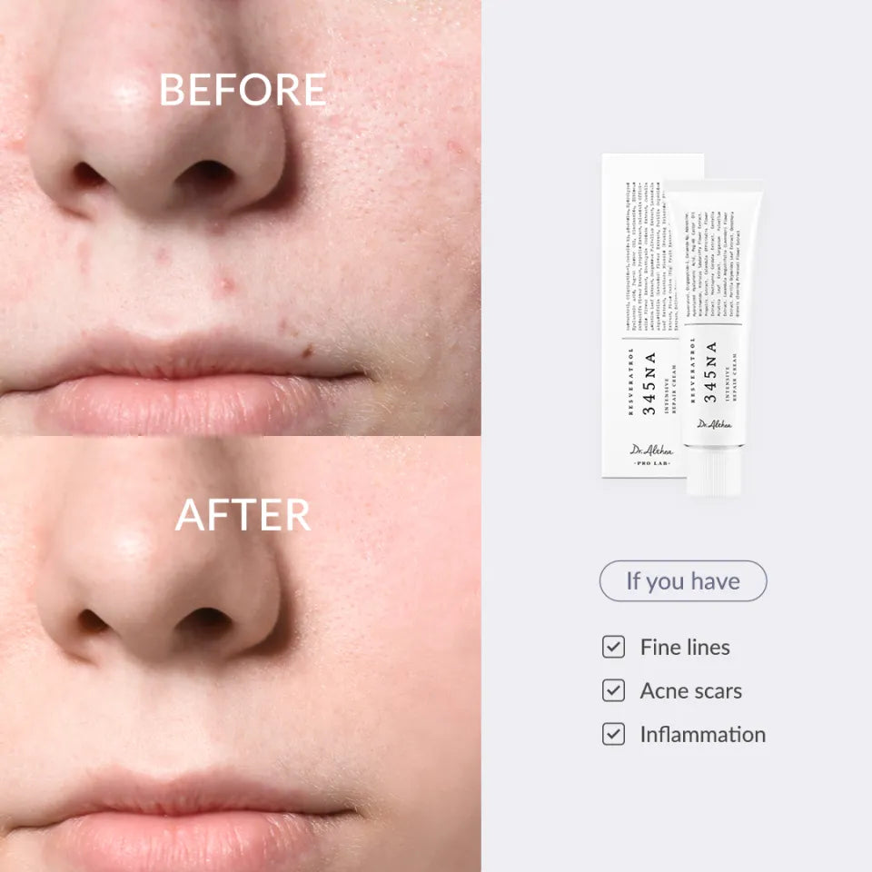 🧴 Dr. Althea 345 Relief Cream 🌿